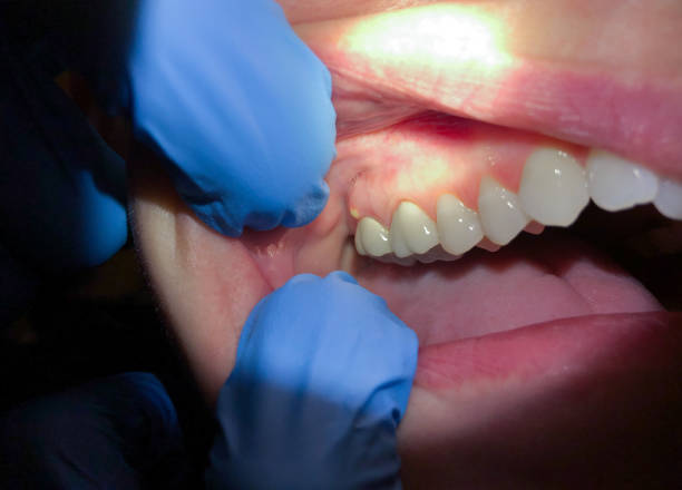 Best Emergency Dentist for Knocked-Out Tooth in Seaside Heights, NJ
