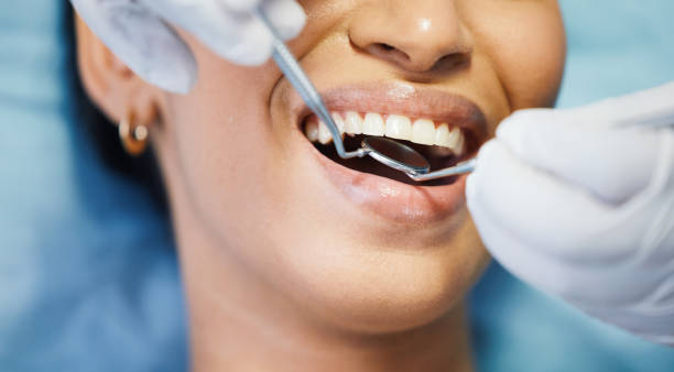 Best Emergency Dentist for Lost Fillings or Crowns in Seaside Heights, NJ